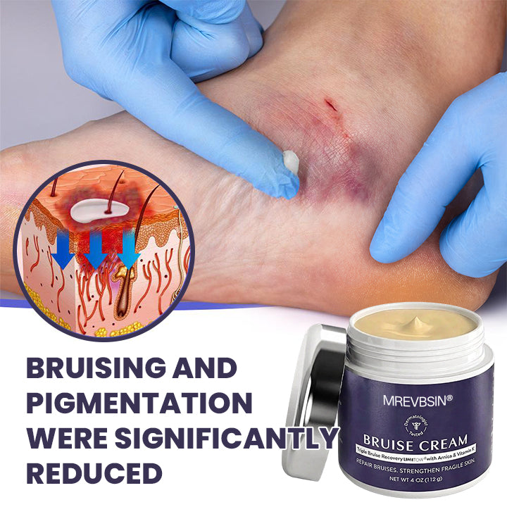 💥100K+ SOLD🍷 𝐌𝐑𝐄𝐕𝐁𝑺𝑰𝑵® NEW Upgraded Bruise Repair Cream | Skin-Strengthening Formula for Easily Bruised Skin
