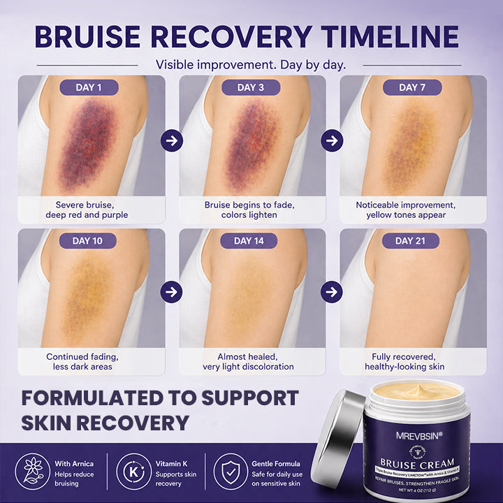 💥100K+ SOLD🍷 𝐌𝐑𝐄𝐕𝐁𝑺𝑰𝑵® NEW Upgraded Bruise Repair Cream | Skin-Strengthening Formula for Easily Bruised Skin