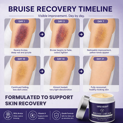 💥100K+ SOLD🍷 𝐌𝐑𝐄𝐕𝐁𝑺𝑰𝑵® NEW Upgraded Bruise Repair Cream | Skin-Strengthening Formula for Easily Bruised Skin