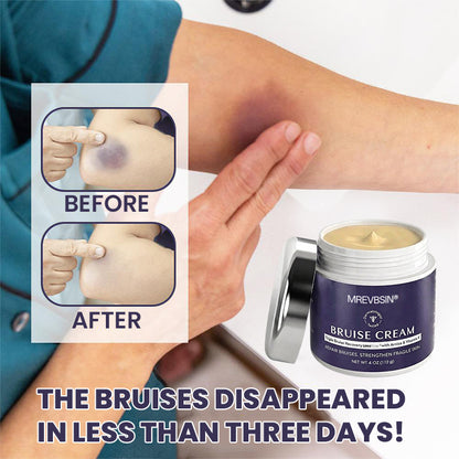 💥100K+ SOLD🍷 𝐌𝐑𝐄𝐕𝐁𝑺𝑰𝑵® NEW Upgraded Bruise Repair Cream | Skin-Strengthening Formula for Easily Bruised Skin