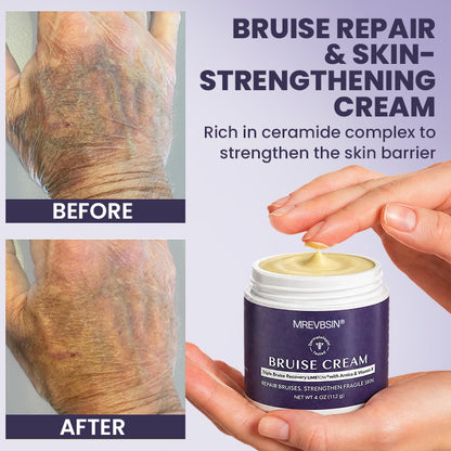 💥100K+ SOLD🍷 𝐌𝐑𝐄𝐕𝐁𝑺𝑰𝑵® NEW Upgraded Bruise Repair Cream | Skin-Strengthening Formula for Easily Bruised Skin